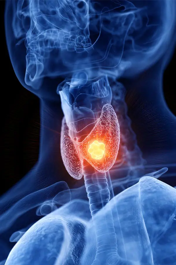 Thyroid-Imbalance-Treatment A 3D illustration of an x-ray of a human neck, highlighting the thyroid. Get help with thyroid imbalance from AZENA Health & Longevity in Gainesville.